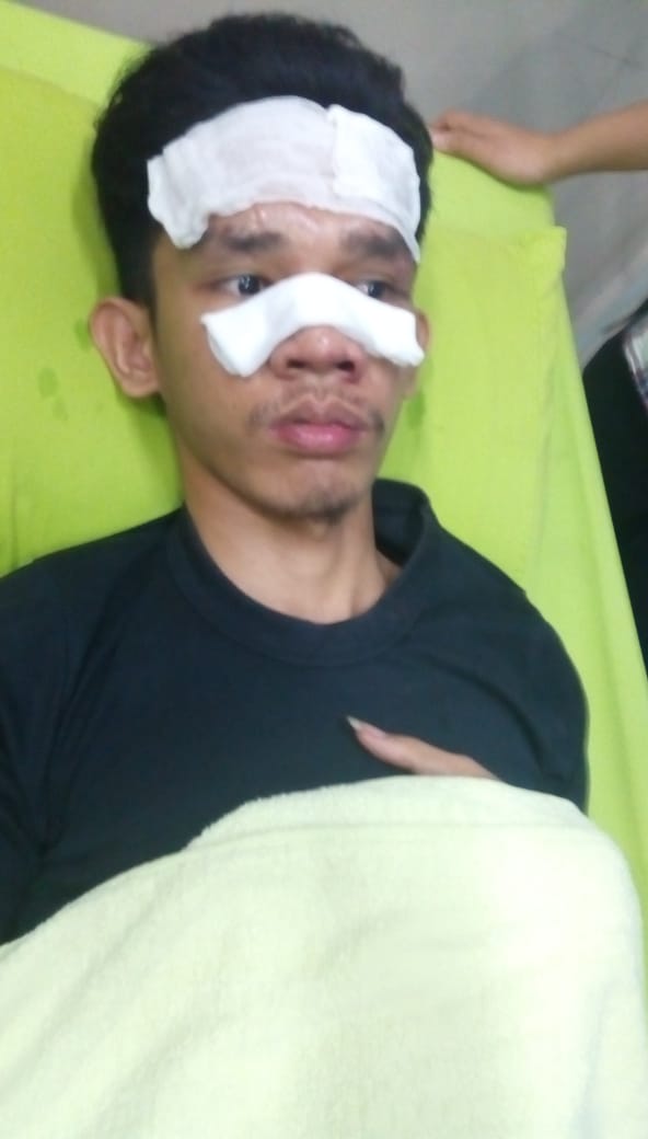 Hendak Antar Makanan, dua Remaja Gereja Luka-luka di Gimbal Sekelompok Orang