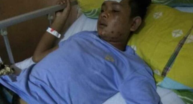 Mahasiswa Fisip ini Terkena Kanker Darah, Ormawa Unimal Ajak Semua Pihak Bantu si Penderita