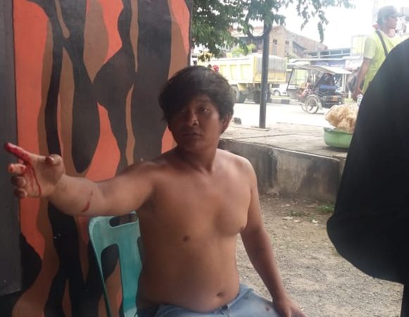 Adu Nyali, Gondrong Kena Tikam Cantik 3 Liang