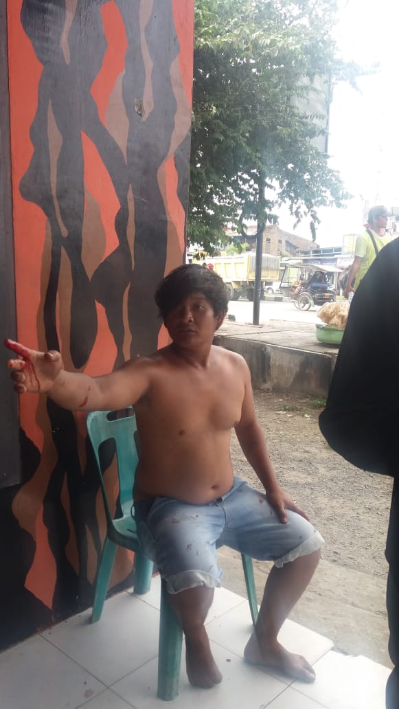 Adu Nyali, Gondrong Kena Tikam Cantik 3 Liang