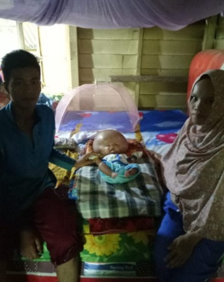 Balita 4 Bulan Penderita  Hidrosefalus Butuh Bantuan