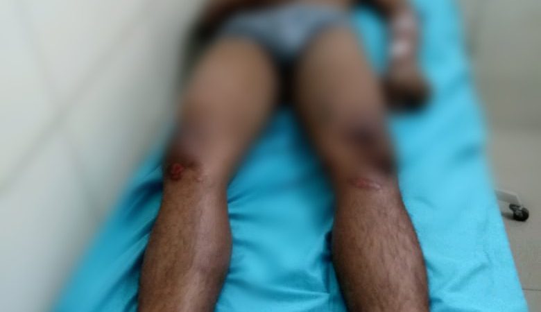 Baru Keluar Dari Penjara,  Tewas di Massa