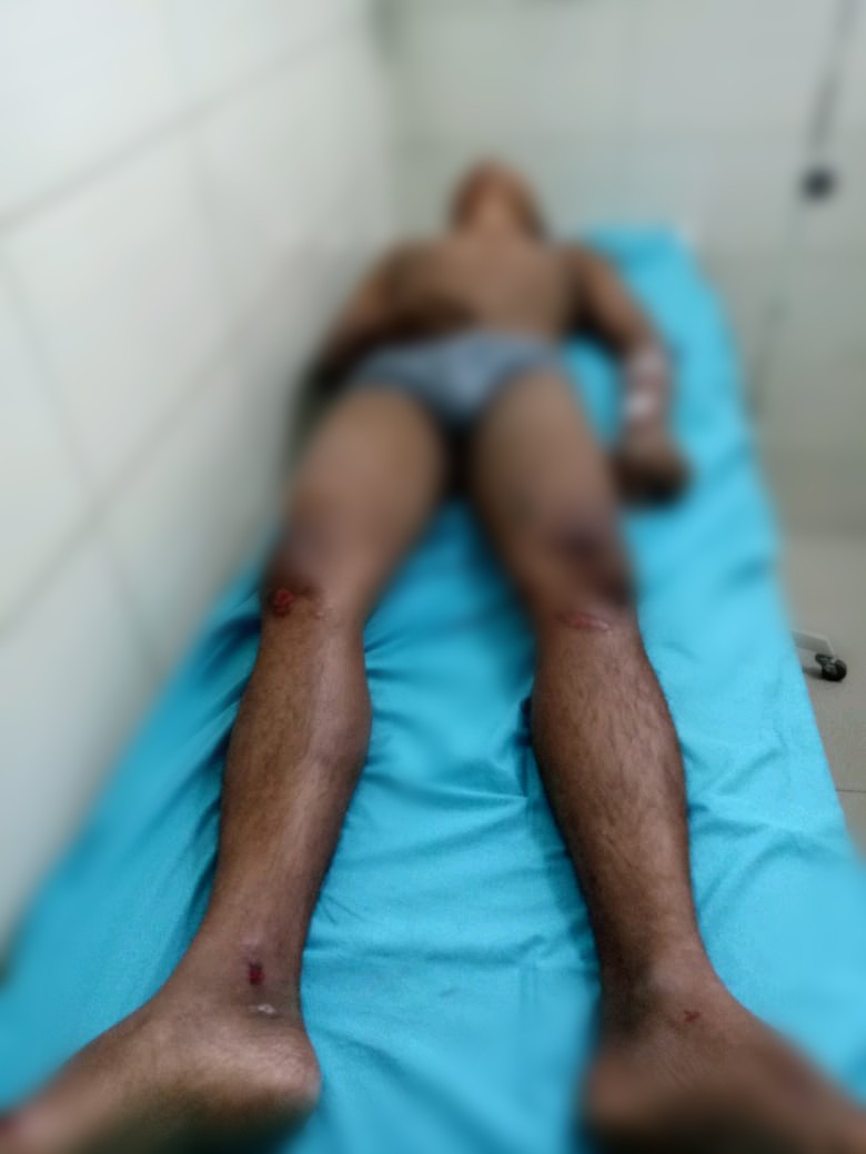 Baru Keluar Dari Penjara,  Tewas di Massa