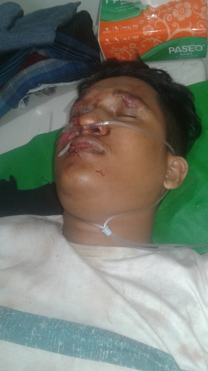 Komplotan Jambret Beraksi di Depan Pool Bus PMTOH, 2 Kritis 2 Lagi Kabur