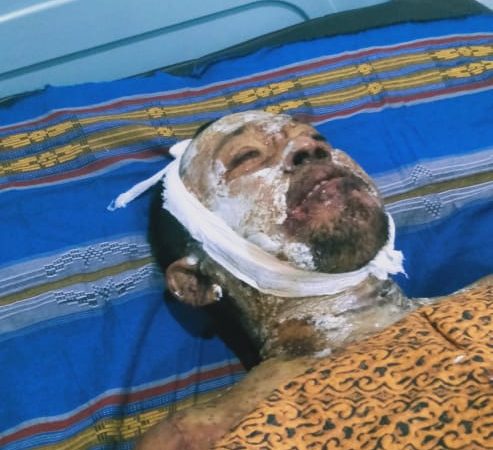 Nelayan Tewas Setelah Terpeleset Dan Masuk Kedalam Dandang Perebusan Ikan Teri