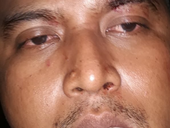 Di Aniaya oleh Oknum Kadus bersama 40 Pelaku, Warga Tembung Nyaris Tewas di Pancur Batu