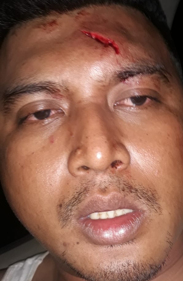 Di Aniaya oleh Oknum Kadus bersama 40 Pelaku, Warga Tembung Nyaris Tewas di Pancur Batu