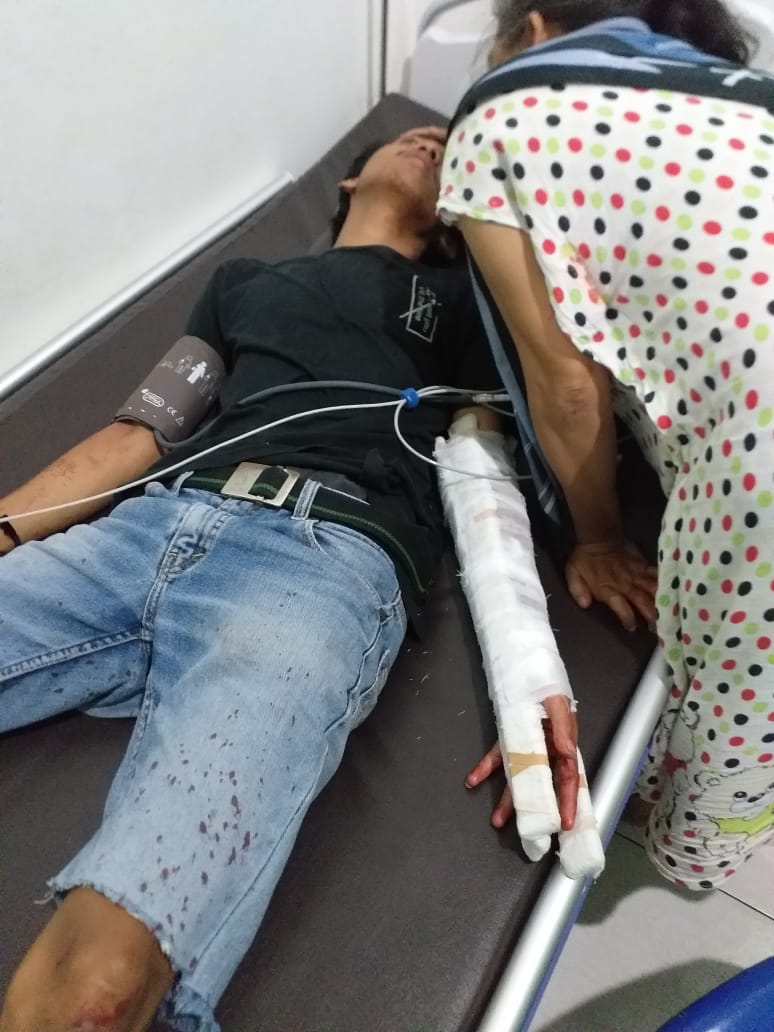 Dituduh Mencuri LPG,  Tangan Ali Nyaris Putus Disamurai Tetangga
