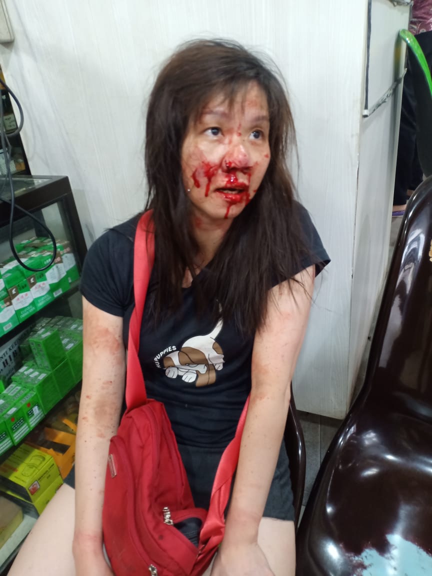Wanita Tionghoa Berdarah-darah di Hajar Perampok