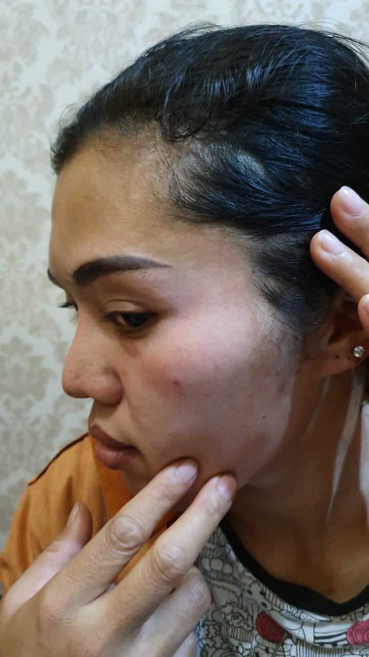 Brutal, Ibu Hamil di Babal Tetangga Hingga Babak Belur
