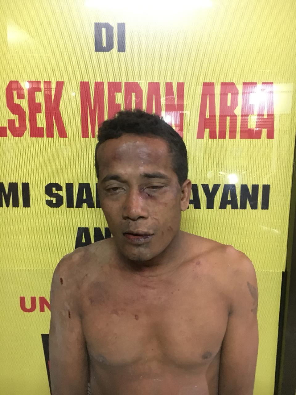 Rampas HP Mahasiswi di Jermal 4, Suroso Nyaris Tewas Mandi Darah