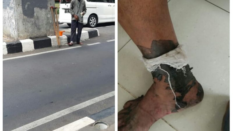 Petugas Satgas P3S Sudis Sosial Jakarta Pusat Pantau Gelandangan Dan Pengemis Pura-Pura Pincang