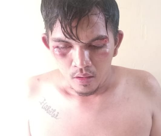 Nyaris di Bakar Warga, Nyawa Penjambret Diselamatkan Polisi