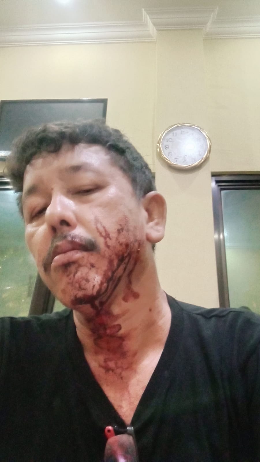 Istri Juang Naibaho Mohon Pelaku Penembakan Pakai Airsoft Gun Segera Dibekuk