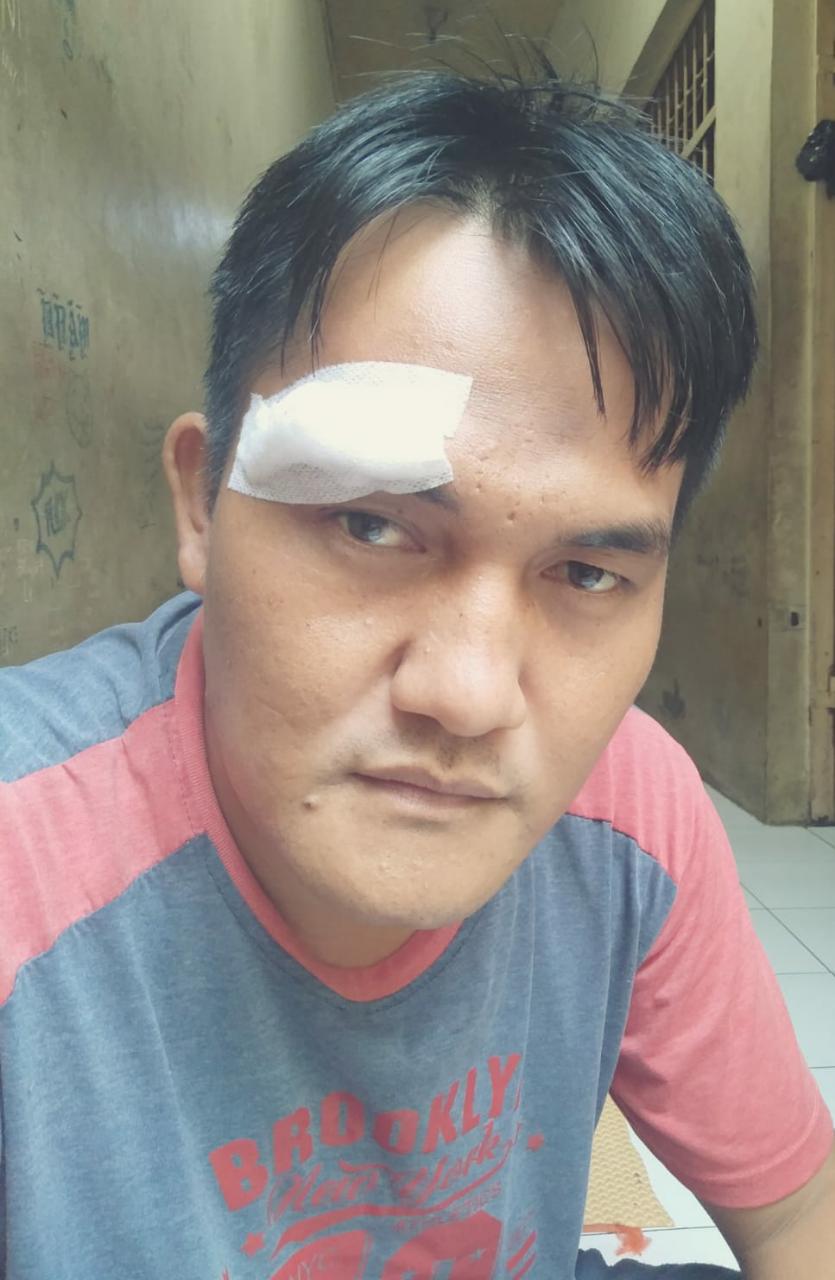 Kasus Pemukulan Yang Dialami Rudini, Didepan Anak Kandung nya Akhirnya Berbuntut Panjang, Pelaku Diminta Pertanggungjawaban