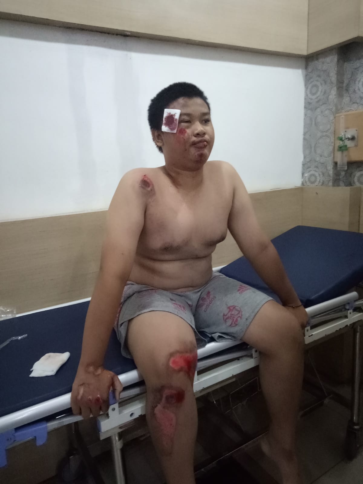 Pulang Sahur Bareng, Risqi dan Raffi Diserang Sekelompok Warga Saat Melintas di Jalan Tengku Amir Hamzah
