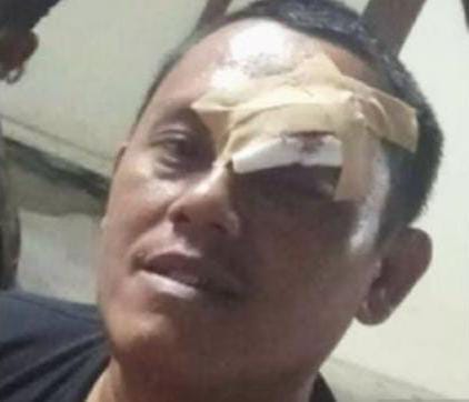 2 Wartawan Diculik dan Dianiaya Oknum ASN Pemkab Karawang, Polisi Segera Bentuk Tim Khusus