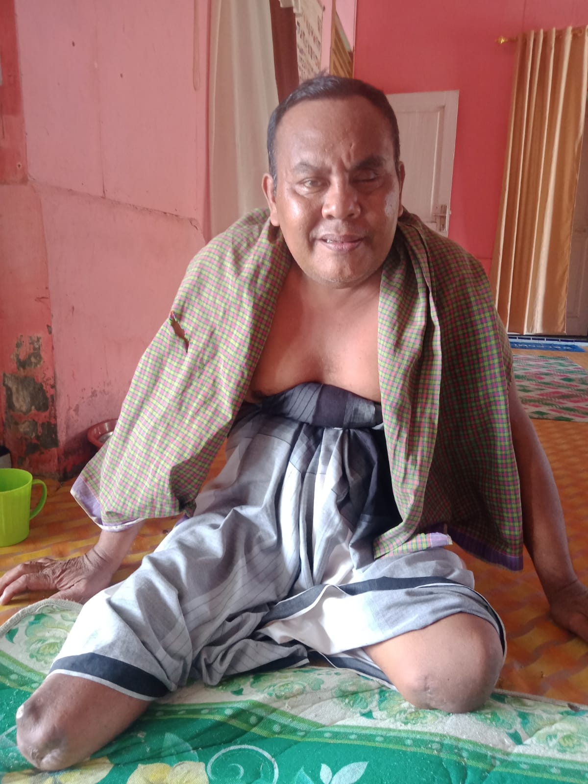 Warga Aceh Utara Penyandang Cacat Disabilitas Butuh Bantuan Sepeda Motor Modifikasi