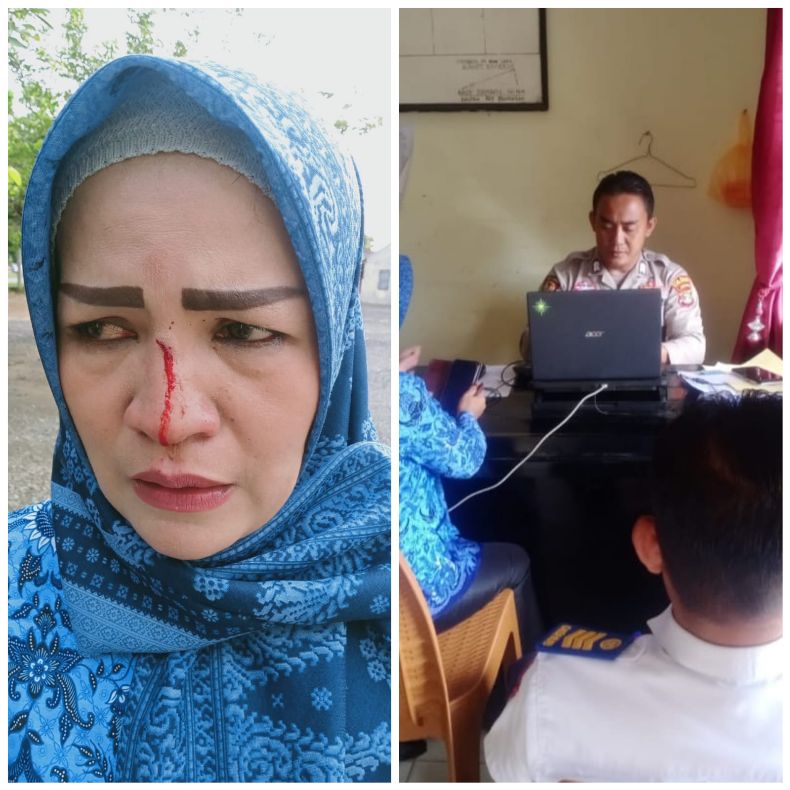 Korban Penganiayaan Oknum Pejabat Di Dinas Pendidikan Melapor ke Polsek Menggala