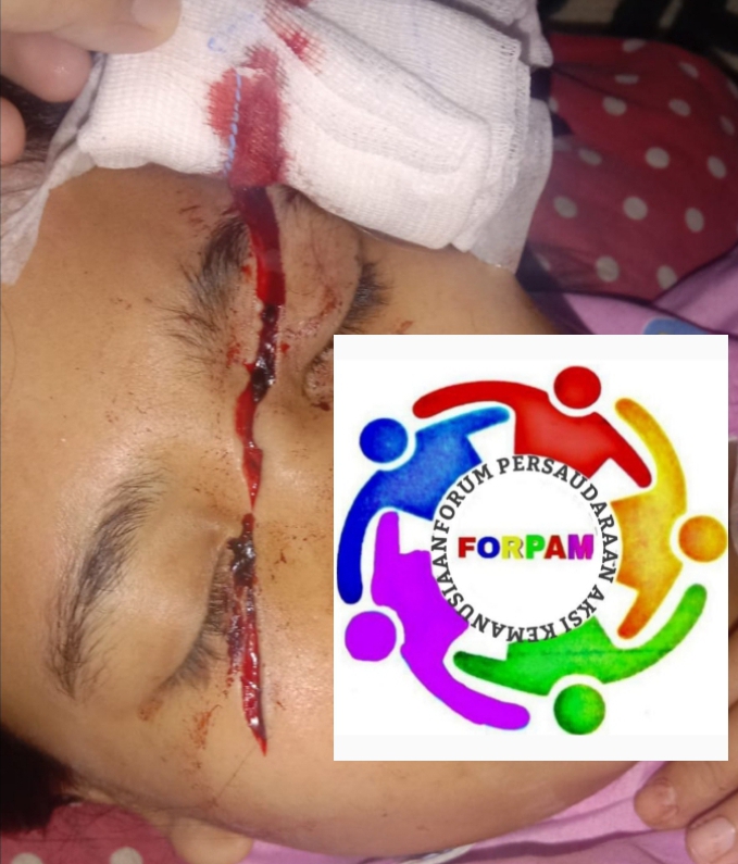 DPP FORPAM SUMUT: Kami Mengutuk Keras Pelaku Penganiayaan Terhadap ‘FB’ Anak Di Bawah Umur!!