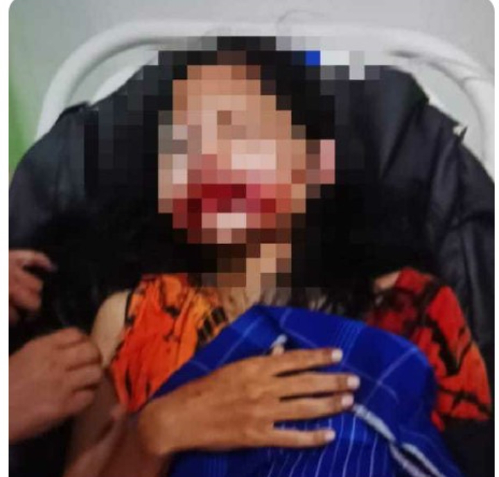 Polisi Buru Perampok yang Aniaya Korban di Paya Bujok Beuramo