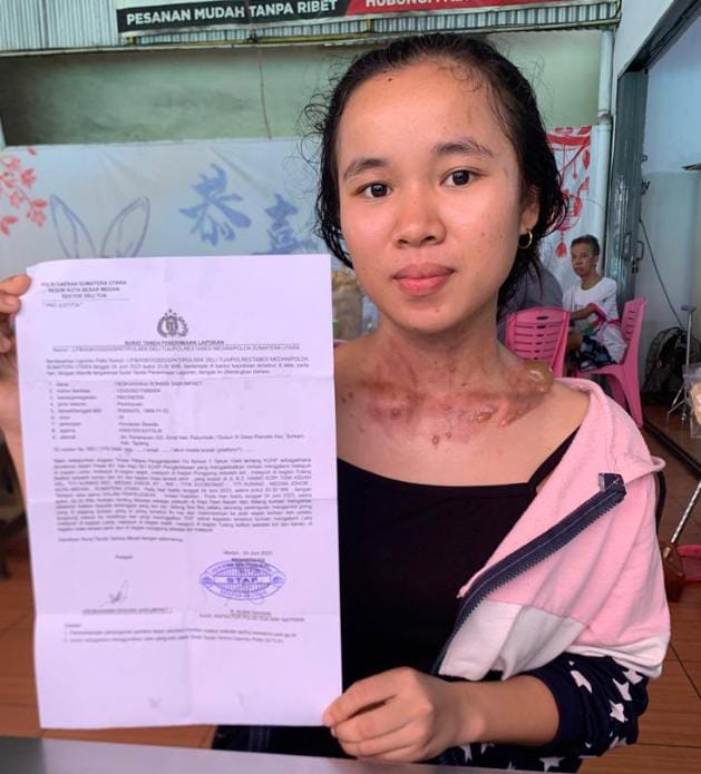 Heskiaanna Sarumpaet Korban Penganiayaan, Minta Polisi Agar Pelaku Segera Ditangkap!!