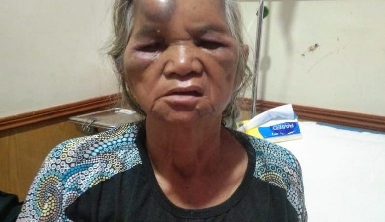 Supir Mobil Box Indomaret Hantam Betor Berpenumpang Seorang Nenek Masuk RSUD Adam Malik