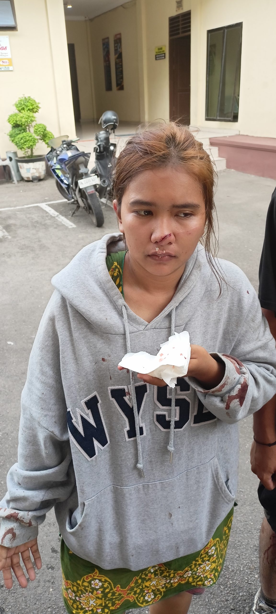 Diduga Ada Dendam, Juliani Purba Dibegal Mantan Suami, Hidung Tersayat Celurit Motor Dilarikan