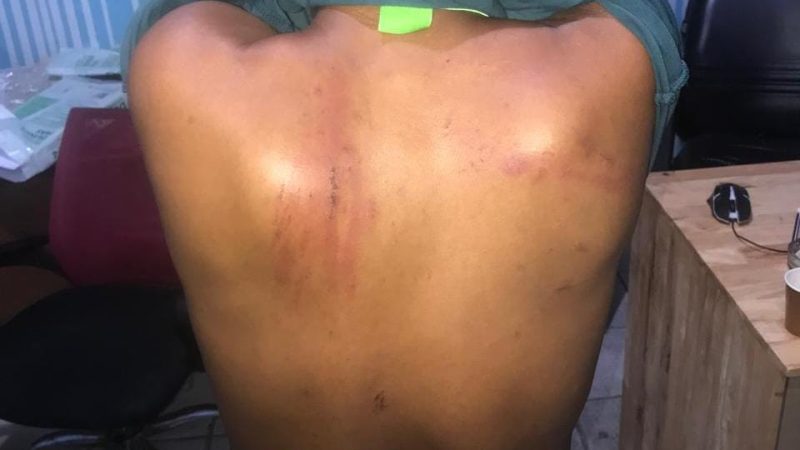 Tragis Nasib Yang Menimpa Leona Bangun,Dituduh mencuri Dan dianiaya oleh Oknum TNI