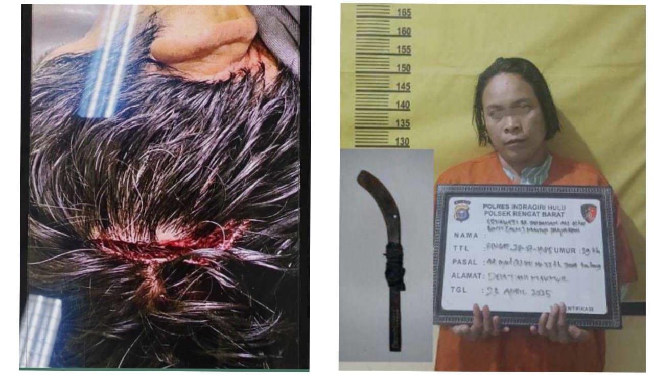 Terungkap Kematian Thomson Ricardo Gultom  ” Di Duga Pelakunya Ternyata Istrinya Sendiri.