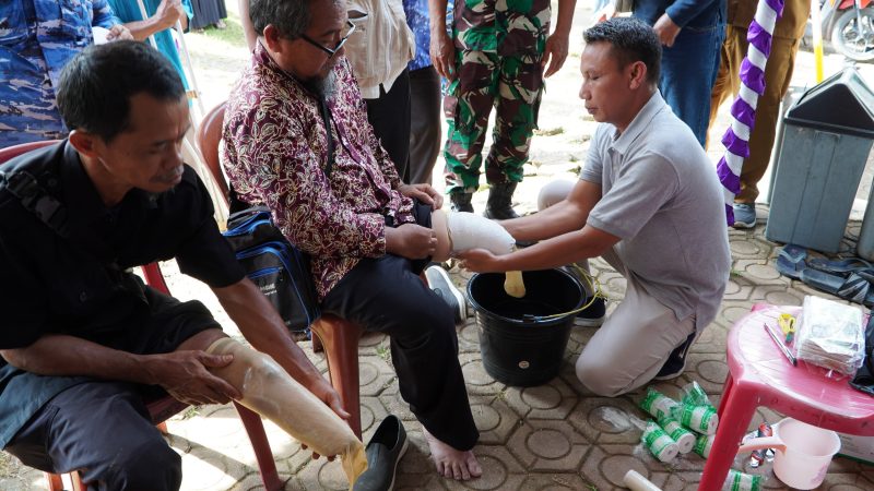 Kaki Palsu, Harapan Nyata untuk Masa Depan Warga