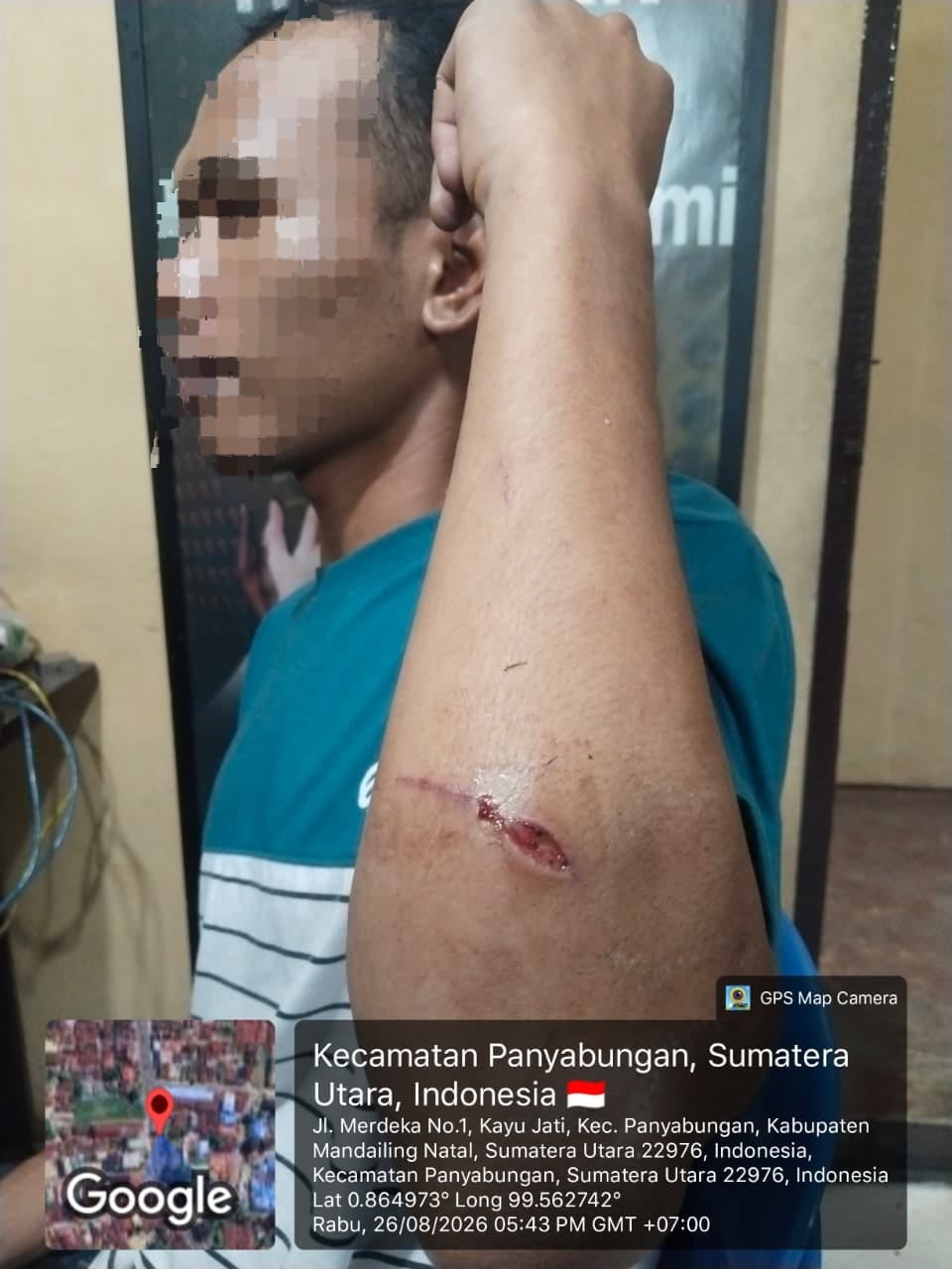 Pengamat Hukum : Polisi Diminta Usut Dan Tindak Tegas Pemilik Lobang PETI Tempat Kejadian Pembacokan Warga